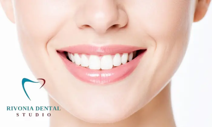 Consultation, Teeth Cleaning & Whitening At Rivonia Dental Studio 1